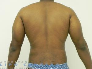 americanlipocenters_86.jpg